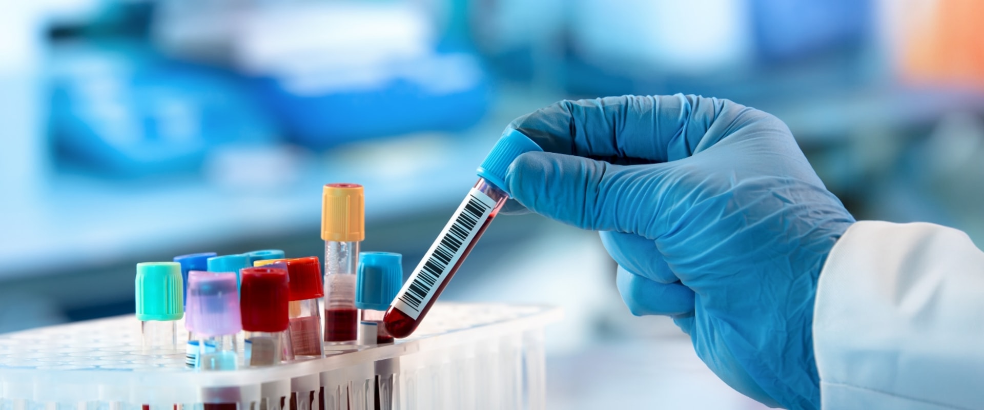 The Importance of Timely Medical Testing in Clark County, Washington: An Expert's Perspective