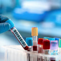 The Importance of Timely Medical Testing in Clark County, Washington: An Expert's Perspective