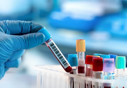 The Importance of Timely Medical Testing in Clark County, Washington: An Expert's Perspective